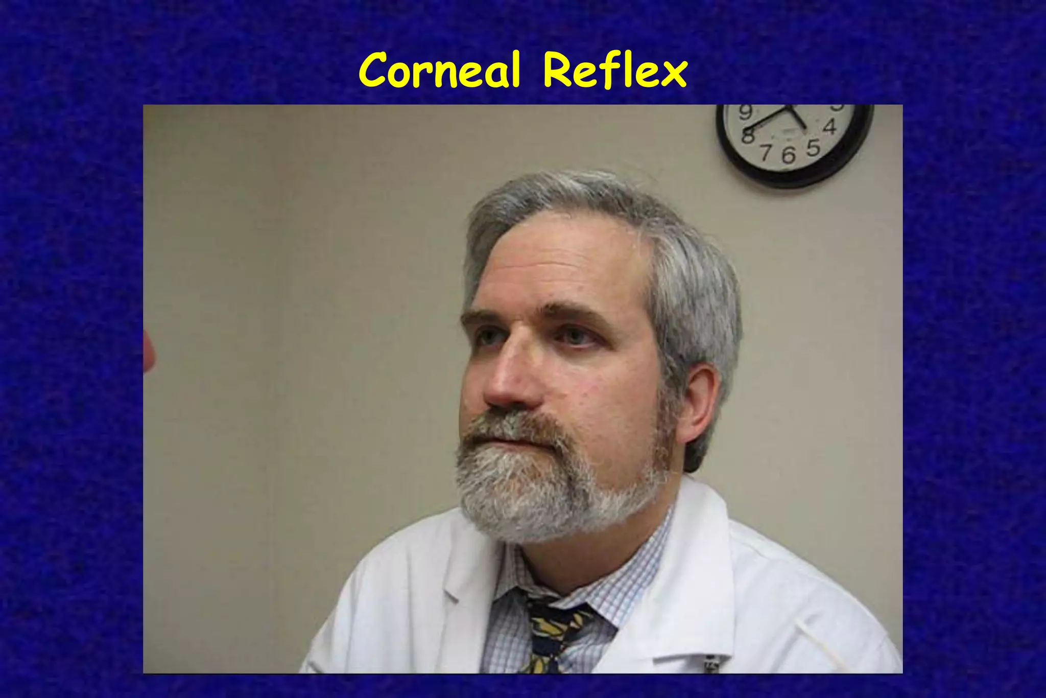 Corneal Reflex
 