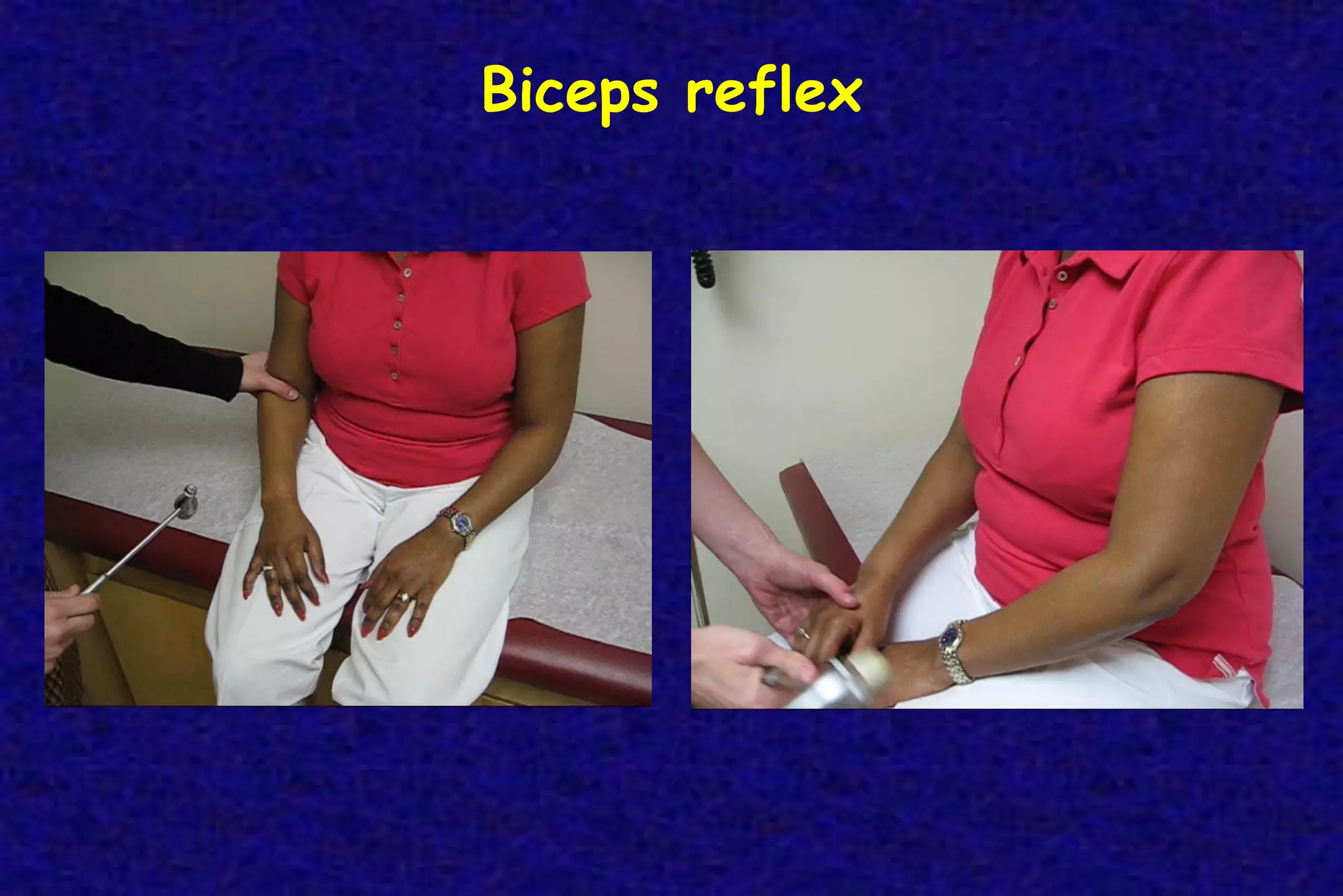Biceps reflex
 