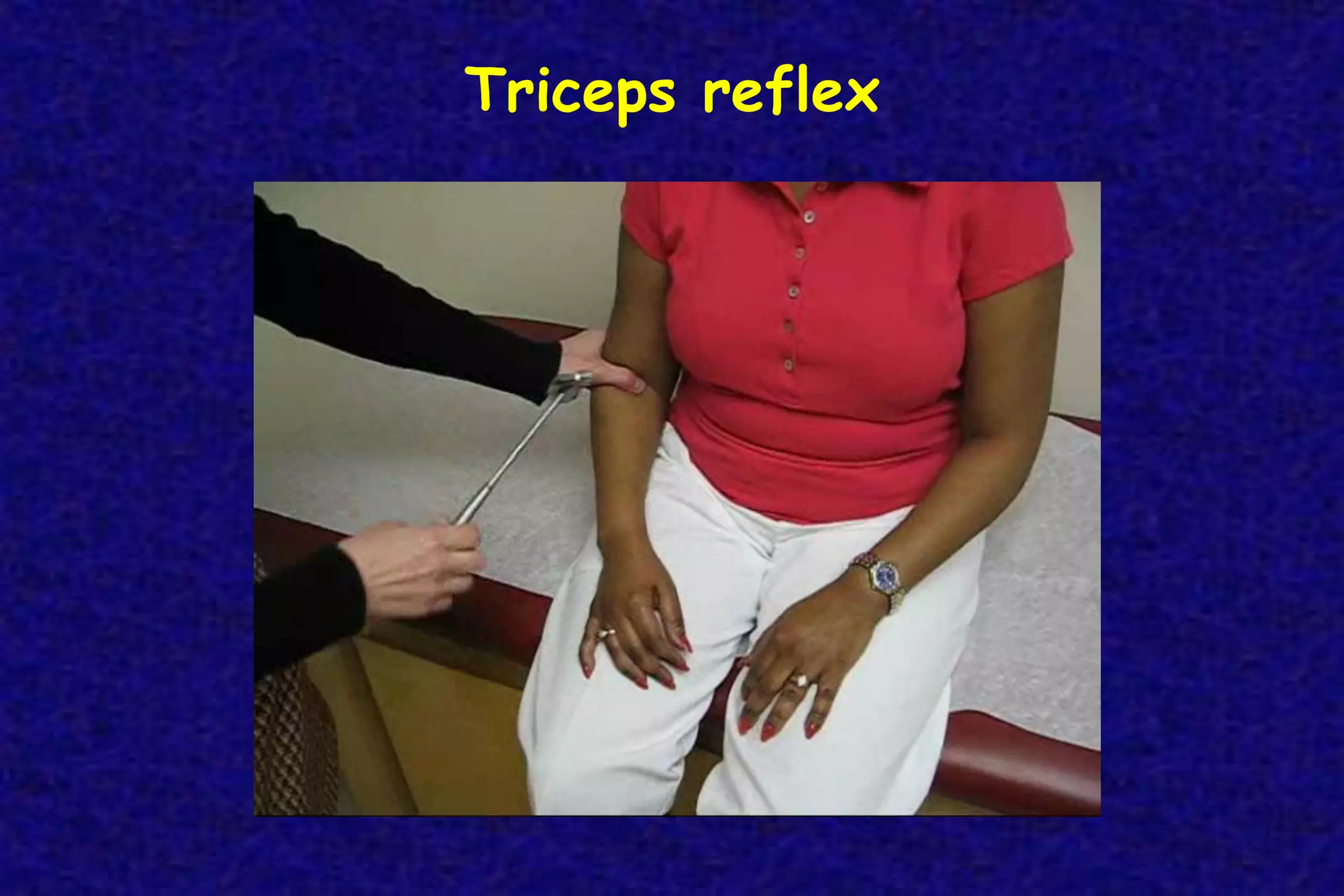 Triceps reflex
 