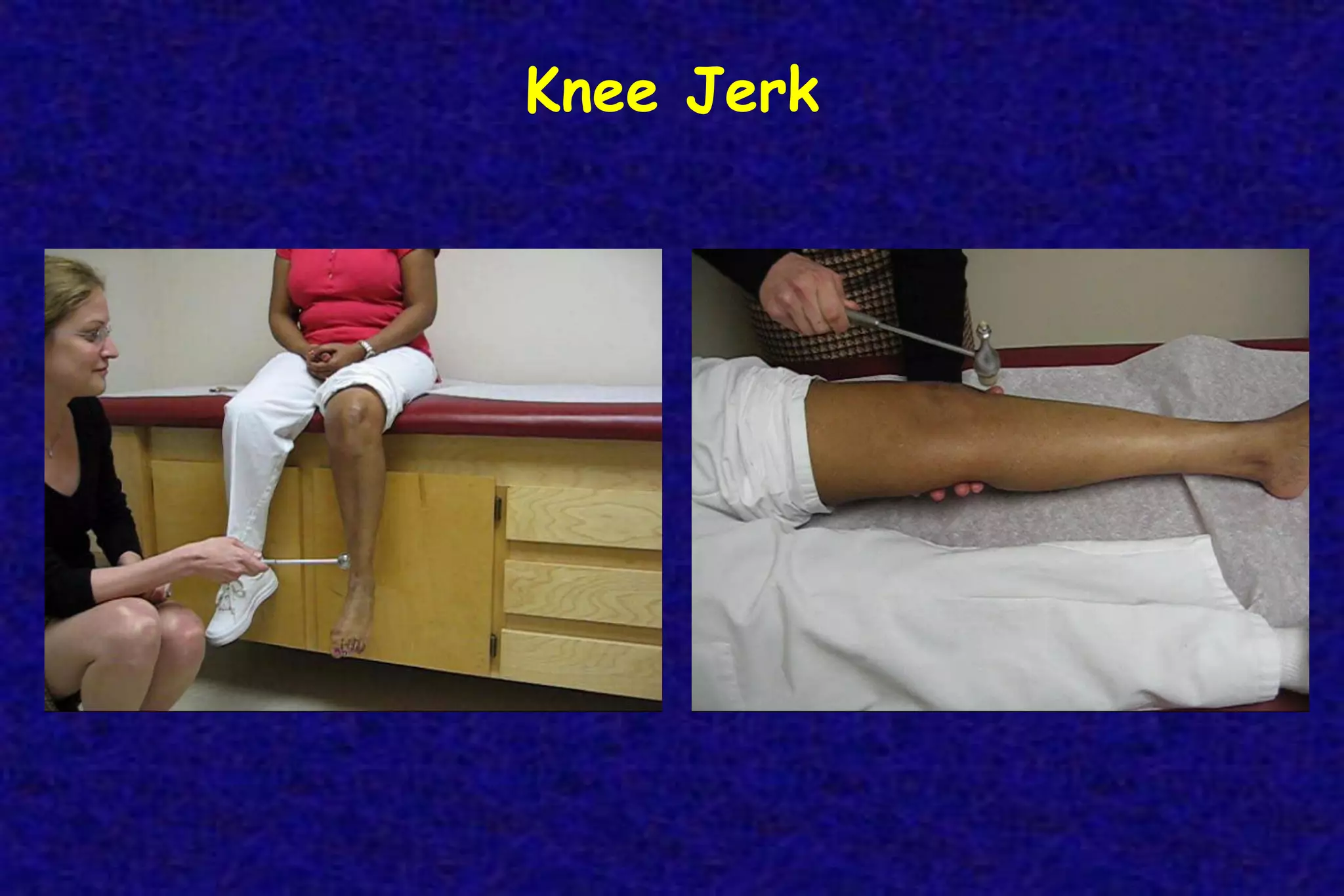 Knee Jerk
 