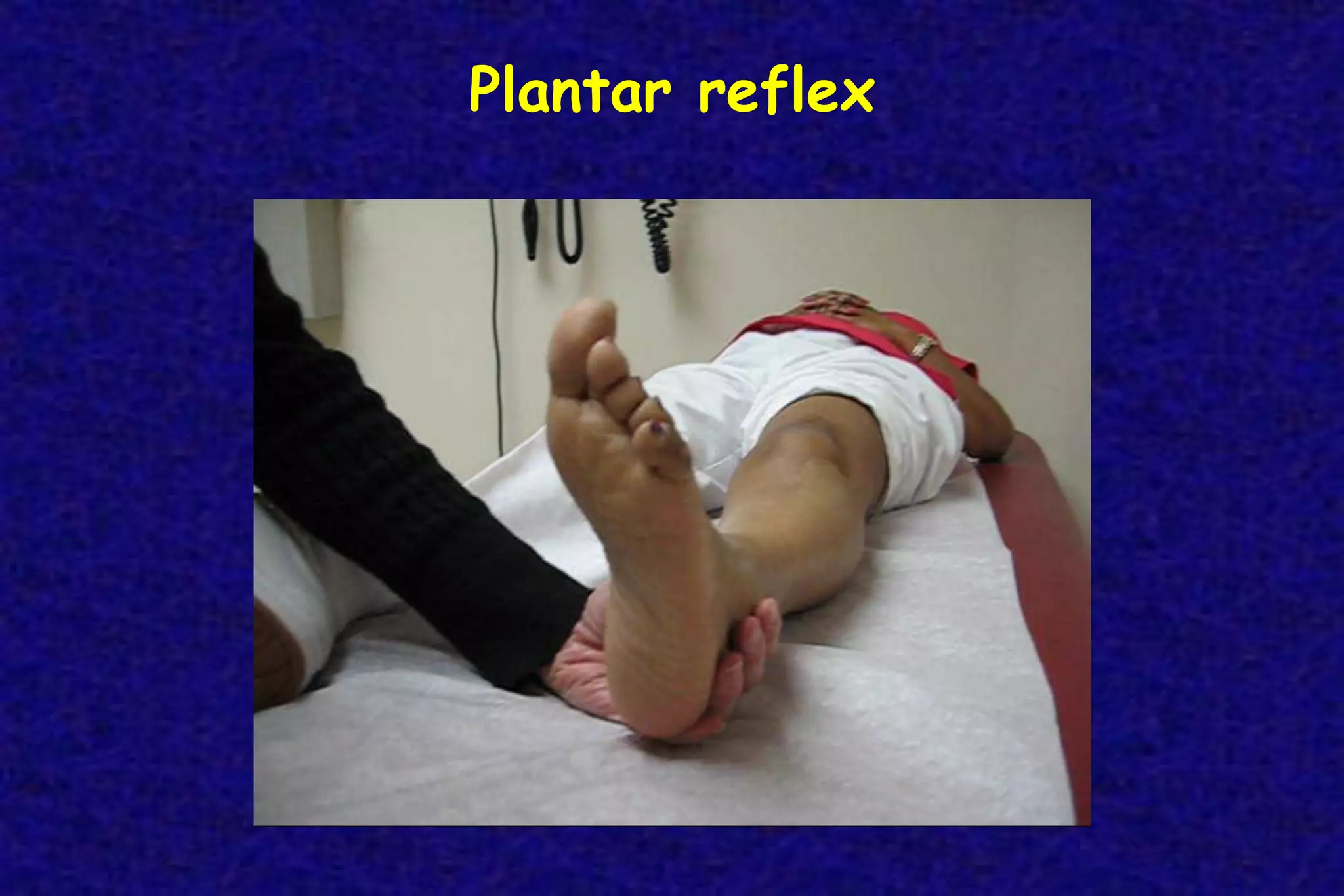 Plantar reflex
 