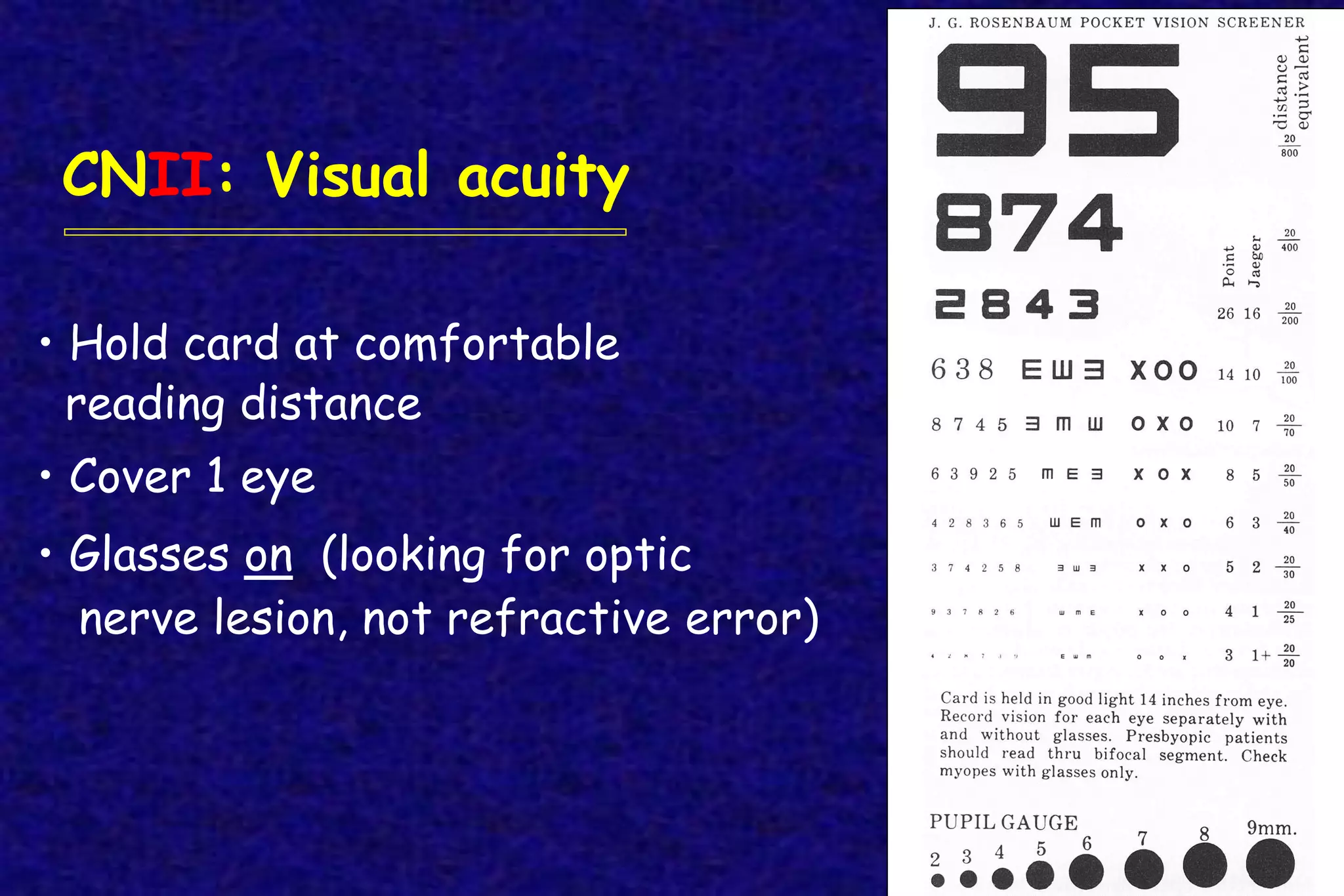 • Hold card at comfortable
reading distance
• Cover 1 eye
• Glasses on (looking for optic
nerve lesion, not refractive error)
CNII: Visual acuity
 