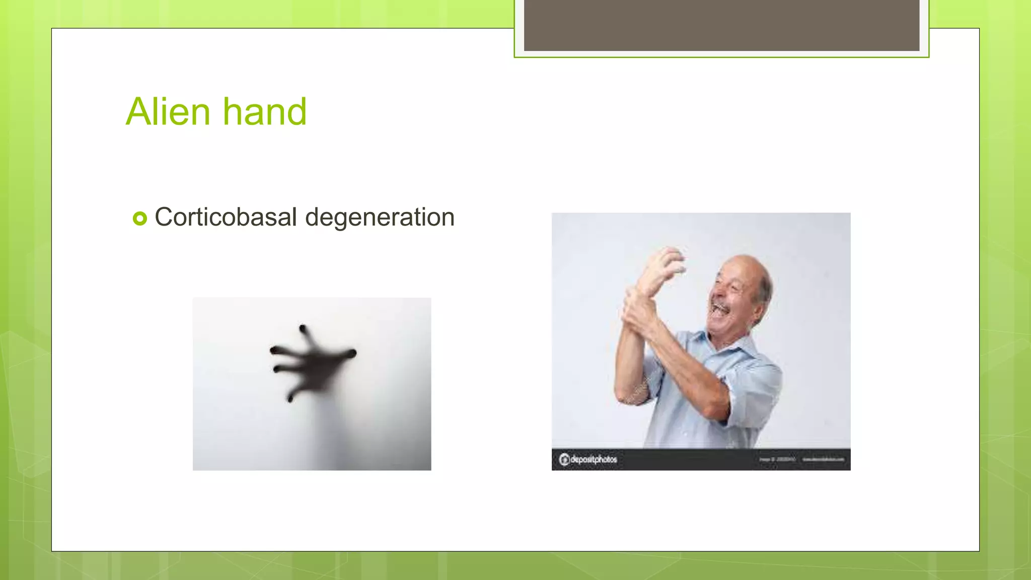 Alien hand
 Corticobasal degeneration
 