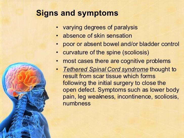 Neurological Disorder Symptoms And Treatments