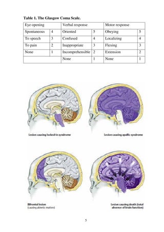 5
Table 1. The Glasgow Coma Scale.
Eye opening Verbal response Motor response
Spontaneous 4 Oriented 5 Obeying 5
To speech 3 Confused 4 Localizing 4
To pain 2 Inappropriate 3 Flexing 3
None 1 Incomprehensible 2 Extension 2
None 1 None 1
 