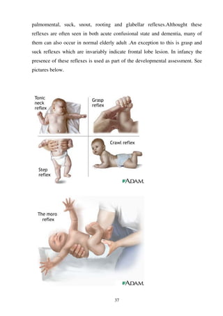 37
palmomental, suck, snout, rooting and glabellar reflexes.Althought these
reflexes are often seen in both acute confusional state and dementia, many of
them can also occur in normal elderly adult .An exception to this is grasp and
suck reflexes which are invariably indicate frontal lobe lesion. In infancy the
presence of these reflexes is used as part of the developmental assessment. See
pictures below.
 