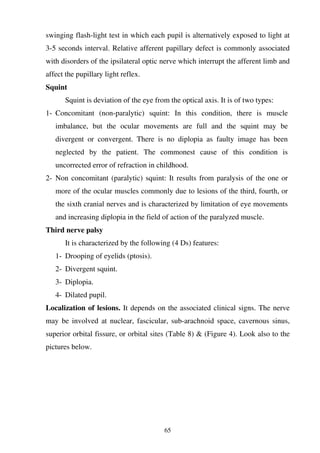 65
swinging flash-light test in which each pupil is alternatively exposed to light at
3-5 seconds interval. Relative afferent papillary defect is commonly associated
with disorders of the ipsilateral optic nerve which interrupt the afferent limb and
affect the pupillary light reflex.
Squint
Squint is deviation of the eye from the optical axis. It is of two types:
1- Concomitant (non-paralytic) squint: In this condition, there is muscle
imbalance, but the ocular movements are full and the squint may be
divergent or convergent. There is no diplopia as faulty image has been
neglected by the patient. The commonest cause of this condition is
uncorrected error of refraction in childhood.
2- Non concomitant (paralytic) squint: It results from paralysis of the one or
more of the ocular muscles commonly due to lesions of the third, fourth, or
the sixth cranial nerves and is characterized by limitation of eye movements
and increasing diplopia in the field of action of the paralyzed muscle.
Third nerve palsy
It is characterized by the following (4 Ds) features:
1- Drooping of eyelids (ptosis).
2- Divergent squint.
3- Diplopia.
4- Dilated pupil.
Localization of lesions. It depends on the associated clinical signs. The nerve
may be involved at nuclear, fascicular, sub-arachnoid space, cavernous sinus,
superior orbital fissure, or orbital sites (Table 8) & (Figure 4). Look also to the
pictures below.
 