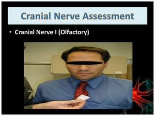 • Cranial Nerve I (Olfactory)
 