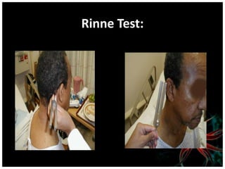 Rinne Test:
 