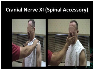 Cranial Nerve XI (Spinal Accessory)
 