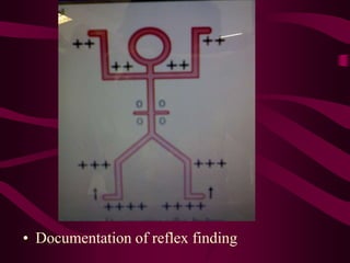 • Documentation of reflex finding
 