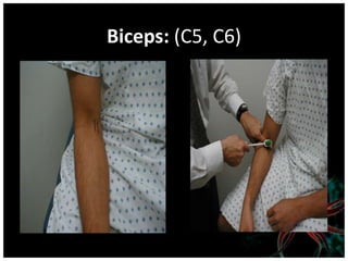 Biceps: (C5, C6)
 