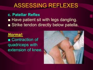 ASSESSING REFLEXES
c. Patellar Reflex
■ Have patient sit with legs dangling.
■ Strike tendon directly below patella.
Normal:
■ Contraction of
quadriceps with
extension of knee.
 