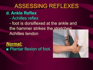 ASSESSING REFLEXES
d. Ankle Reflex
- Achilles reflex
- foot is dorsiflexed at the ankle and
the hammer strikes the stretched
Achilles tendon
Normal:
■ Plantar flexion of foot.
 