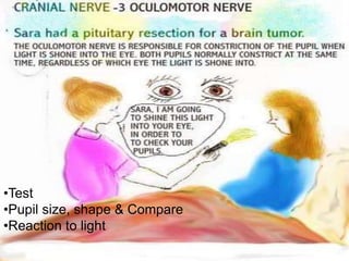 27
•Test
•Pupil size, shape & Compare
•Reaction to light
 
