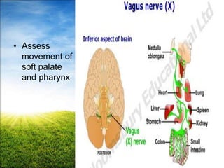 32
Cranial Nerve 10
• Assess
movement of
soft palate
and pharynx
 