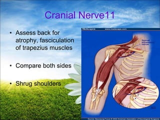 33
Cranial Nerve11
• Assess back for
atrophy, fasciculation
of trapezius muscles
• Compare both sides
• Shrug shoulders
 