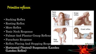 Assessment of Pediatric Nerves System | PPTX