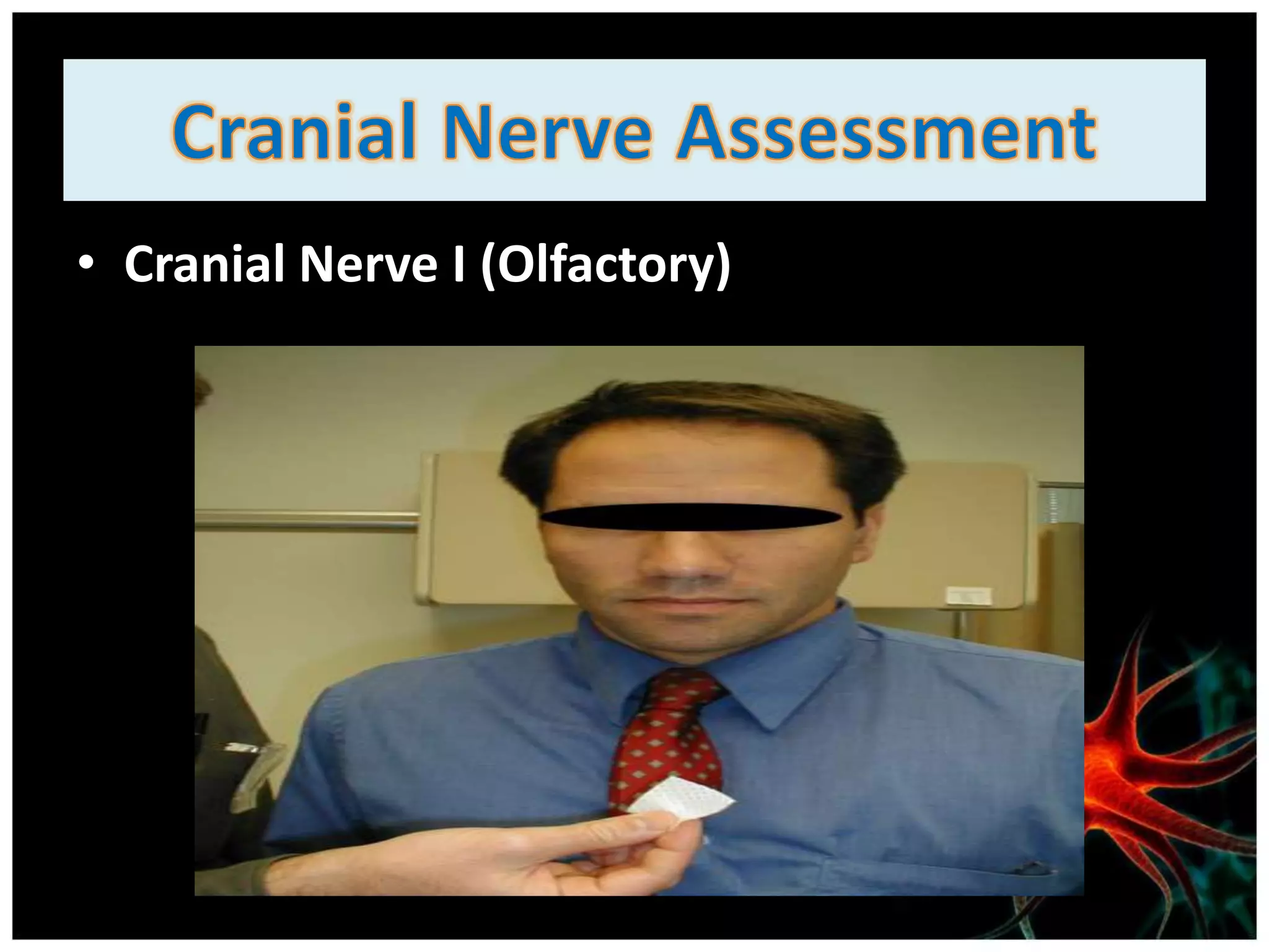 • Cranial Nerve I (Olfactory)
 