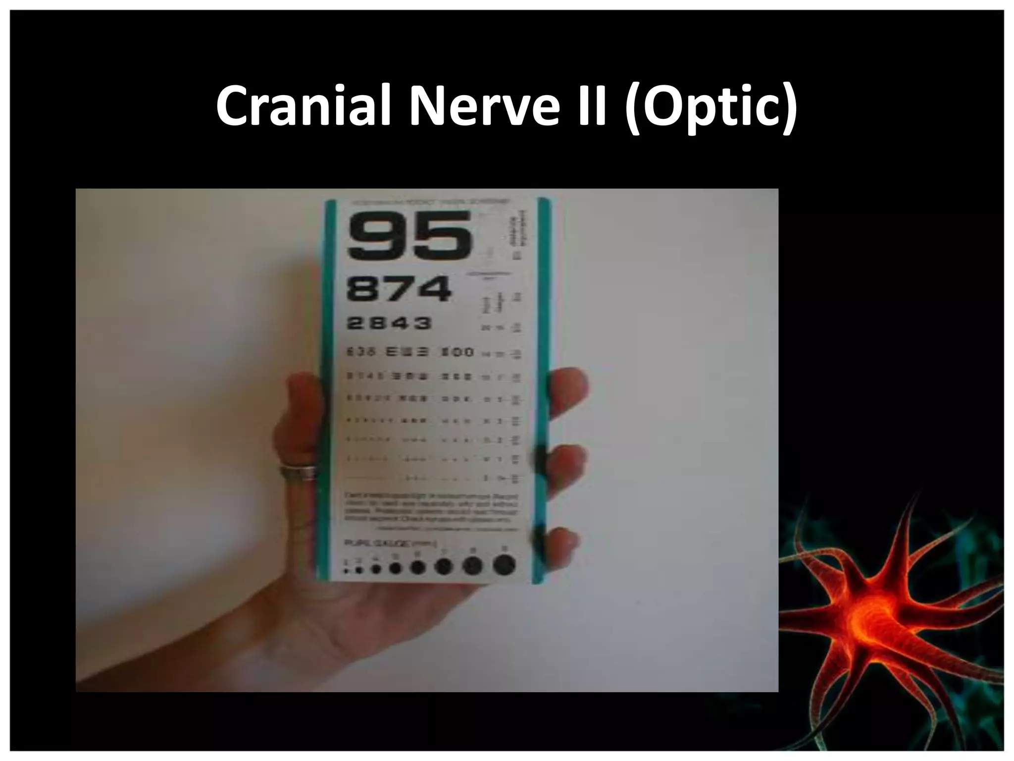 Cranial Nerve II (Optic)
 