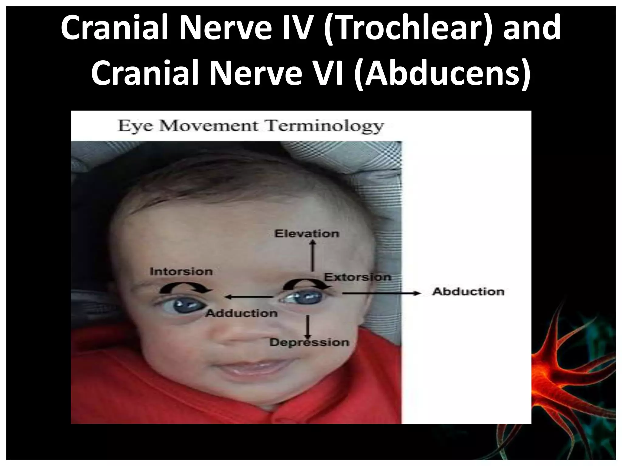 Cranial Nerve IV (Trochlear) and
  Cranial Nerve VI (Abducens)
 
