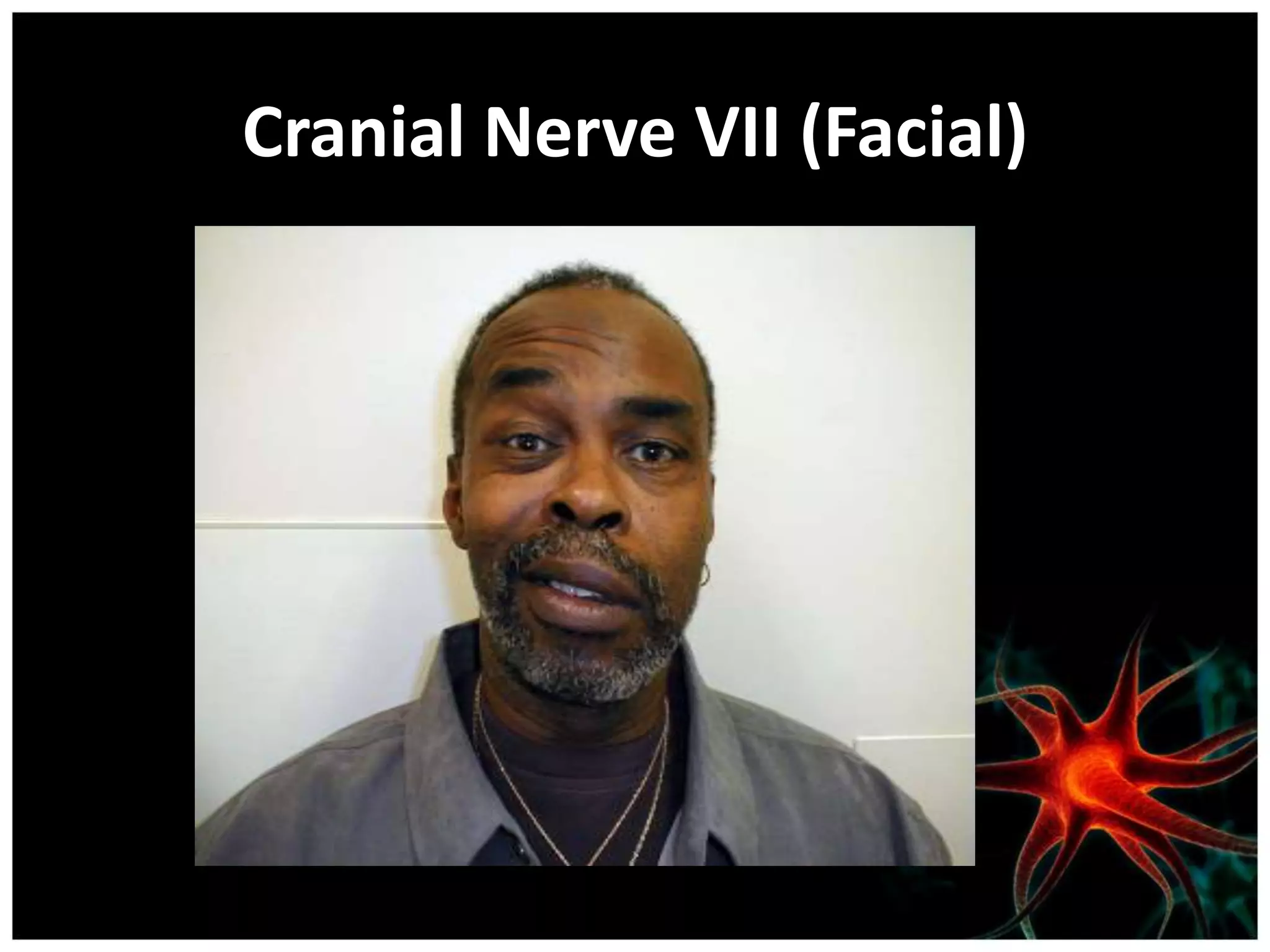 Cranial Nerve VII (Facial)
 