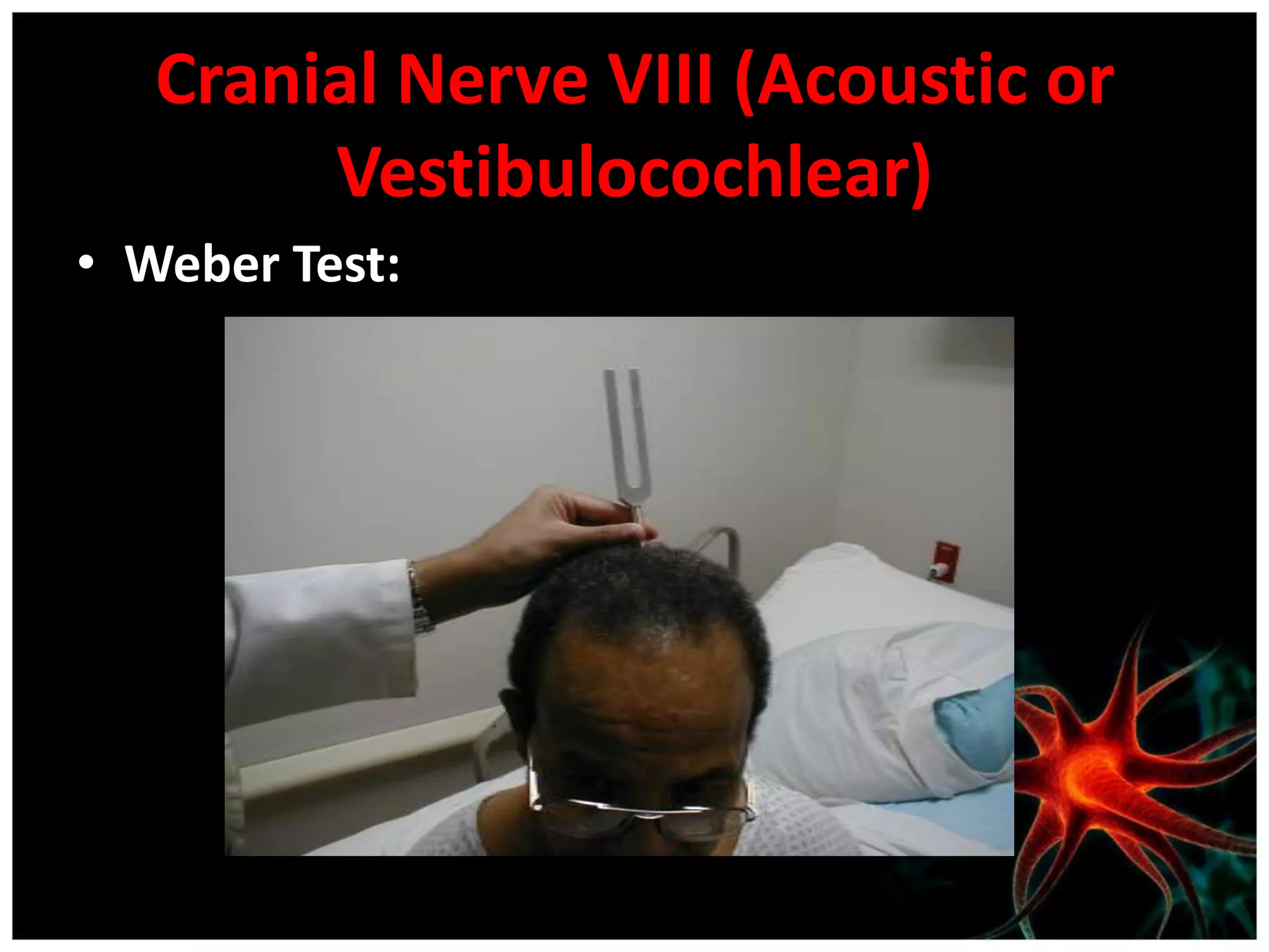 Cranial Nerve VIII (Acoustic or
        Vestibulocochlear)
• Weber Test:
 