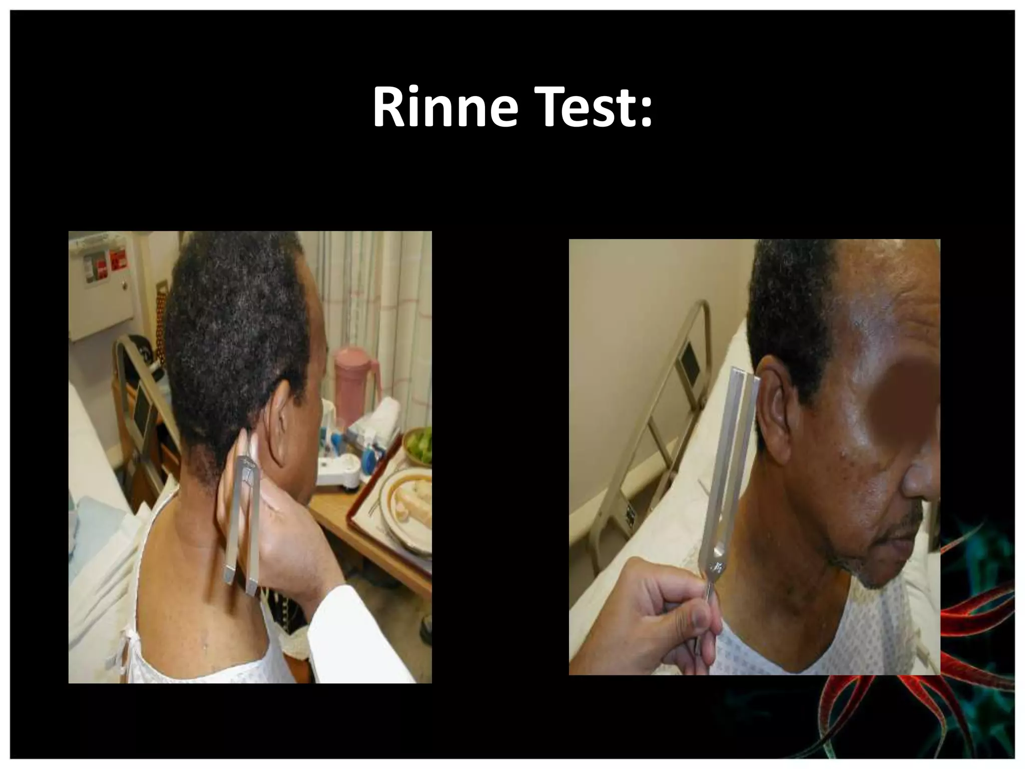 Rinne Test:
 