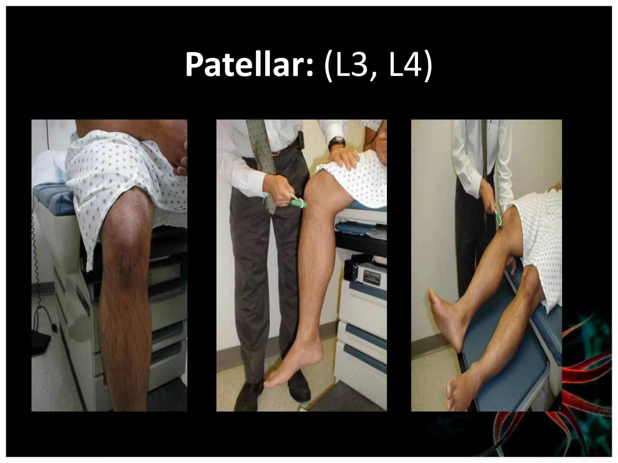 Patellar: (L3, L4)
 