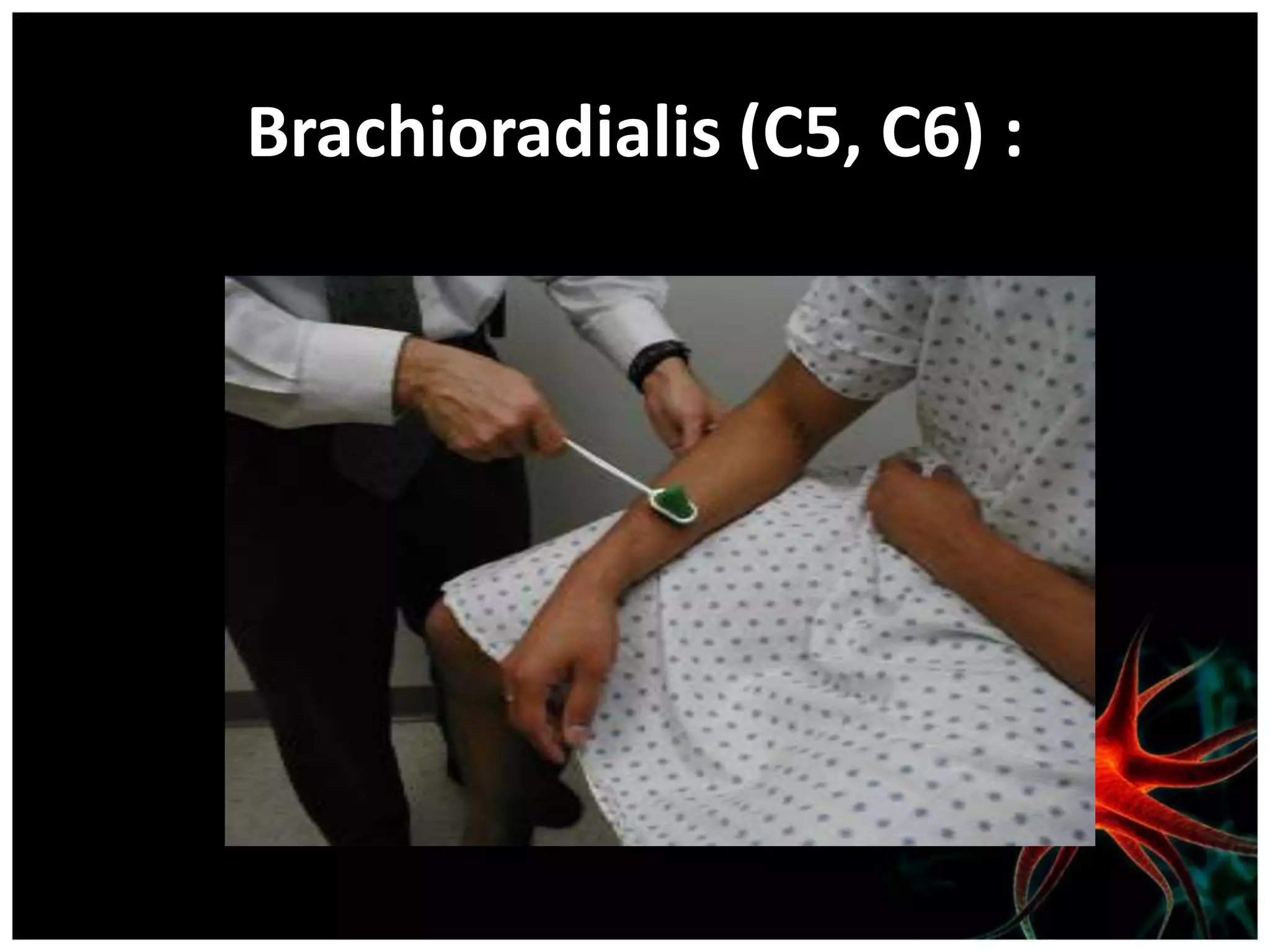 Brachioradialis (C5, C6) :
 