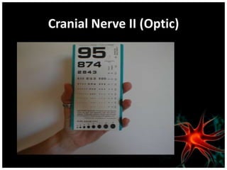 Cranial Nerve II (Optic)
 