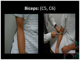 Biceps: (C5, C6)
 
