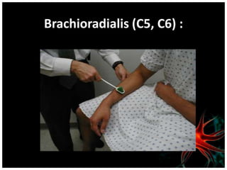 Brachioradialis (C5, C6) :
 