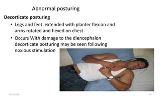 Abnormal posturing
Decorticate posturing
• Legs and feet extended with planter flexion and
arms rotated and flexed on chest
• Occurs With damage to the diencephalon
decorticate posturing may be seen following
noxious stimulation
8/31/2023 45
 