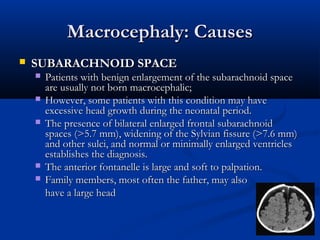 Macrocephaly: Causes
   SUBARACHNOID SPACE
       Patients with benign enlargement of the subarachnoid space
        are usually not born macrocephalic;
       However, some patients with this condition may have
        excessive head growth during the neonatal period.
       The presence of bilateral enlarged frontal subarachnoid
        spaces (>5.7 mm), widening of the Sylvian fissure (>7.6 mm)
        and other sulci, and normal or minimally enlarged ventricles
        establishes the diagnosis.
       The anterior fontanelle is large and soft to palpation.
       Family members, most often the father, may also
        have a large head
 