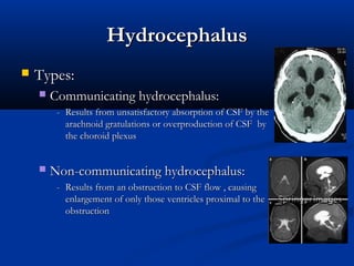 Hydrocephalus
   Types:
       Communicating hydrocephalus:
         - Results from unsatisfactory absorption of CSF by the
           arachnoid gratulations or overproduction of CSF by
           the choroid plexus


       Non-communicating hydrocephalus:
         - Results from an obstruction to CSF flow , causing
           enlargement of only those ventricles proximal to the
           obstruction
 
