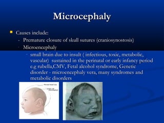 Microcephaly
   Causes include:
     - Premature closure of skull sutures (craniosynostosis)
     - Microencephaly
        - small brain due to insult ( infectious, toxic, metabolic,
          vascular) sustained in the perinatal or early infancy period
          e.g rubella,CMV, Fetal alcohol syndrome, Genetic
          disorder - microencephaly vera, many syndromes and
          metabolic disorders
 