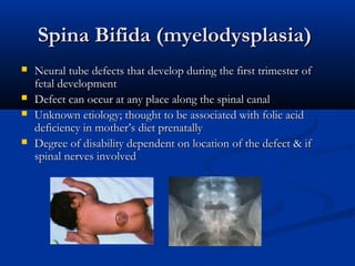 Spina Bifida (myelodysplasia)
   Neural tube defects that develop during the first trimester of
    fetal development
   Defect can occur at any place along the spinal canal
   Unknown etiology; thought to be associated with folic acid
    deficiency in mother’s diet prenatally
   Degree of disability dependent on location of the defect & if
    spinal nerves involved
 