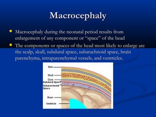 Macrocephaly
   Macrocephaly during the neonatal period results from
    enlargement of any component or “space” of the head
   The components or spaces of the head most likely to enlarge are
    the scalp, skull, subdural space, subarachnoid space, brain
    parenchyma, intraparenchymal vessels, and ventricles.
 