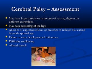 Cerebral Palsy – Assessment
   May have hypertonicity or hypotonia of varying degrees on
    different extremities
   May have scissoring of the legs
   Absence of expected reflexes or presence of reflexes that extend
    beyond expected age
   Failure to meet developmental milestones
   Difficulty swallowing
   Altered speech
 