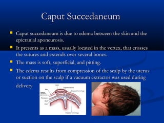 Caput Succedaneum
   Caput succedaneum is due to edema between the skin and the
    epicranial aponeurosis.
   It presents as a mass, usually located in the vertex, that crosses
    the sutures and extends over several bones.
   The mass is soft, superficial, and pitting.
   The edema results from compression of the scalp by the uterus
    or suction on the scalp if a vacuum extractor was used during
    delivery
 