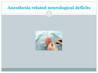 Neurological complications of regional anesthesia in obstetrics ppt