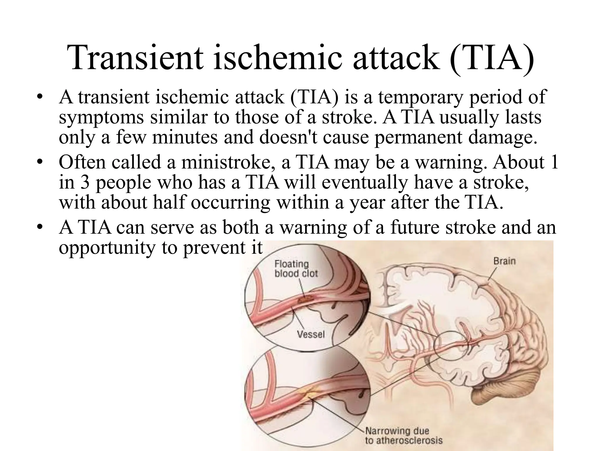 Transient ischemic attack (TIA)
• A transient ischemic attack (TIA) is a temporary period of
symptoms similar to those of a stroke. A TIA usually lasts
only a few minutes and doesn't cause permanent damage.
• Often called a ministroke, a TIA may be a warning. About 1
in 3 people who has a TIA will eventually have a stroke,
with about half occurring within a year after the TIA.
• A TIA can serve as both a warning of a future stroke and an
opportunity to prevent it
 