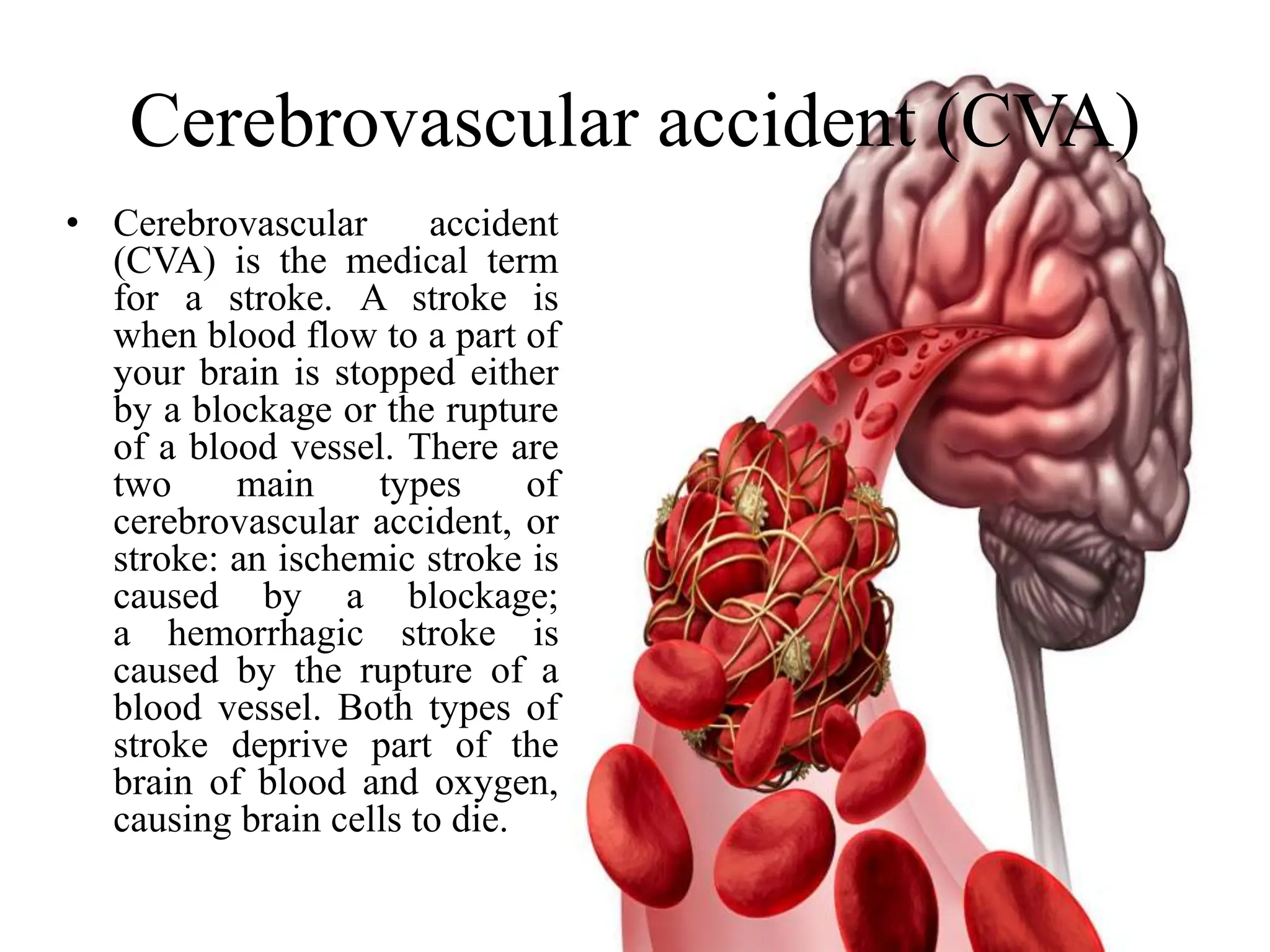 Cerebrovascular accident (CVA)
• Cerebrovascular accident
(CVA) is the medical term
for a stroke. A stroke is
when blood flow to a part of
your brain is stopped either
by a blockage or the rupture
of a blood vessel. There are
two main types of
cerebrovascular accident, or
stroke: an ischemic stroke is
caused by a blockage;
a hemorrhagic stroke is
caused by the rupture of a
blood vessel. Both types of
stroke deprive part of the
brain of blood and oxygen,
causing brain cells to die.
 