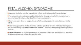 FETAL ALCOHOL
SYNDROME (FAS)
 