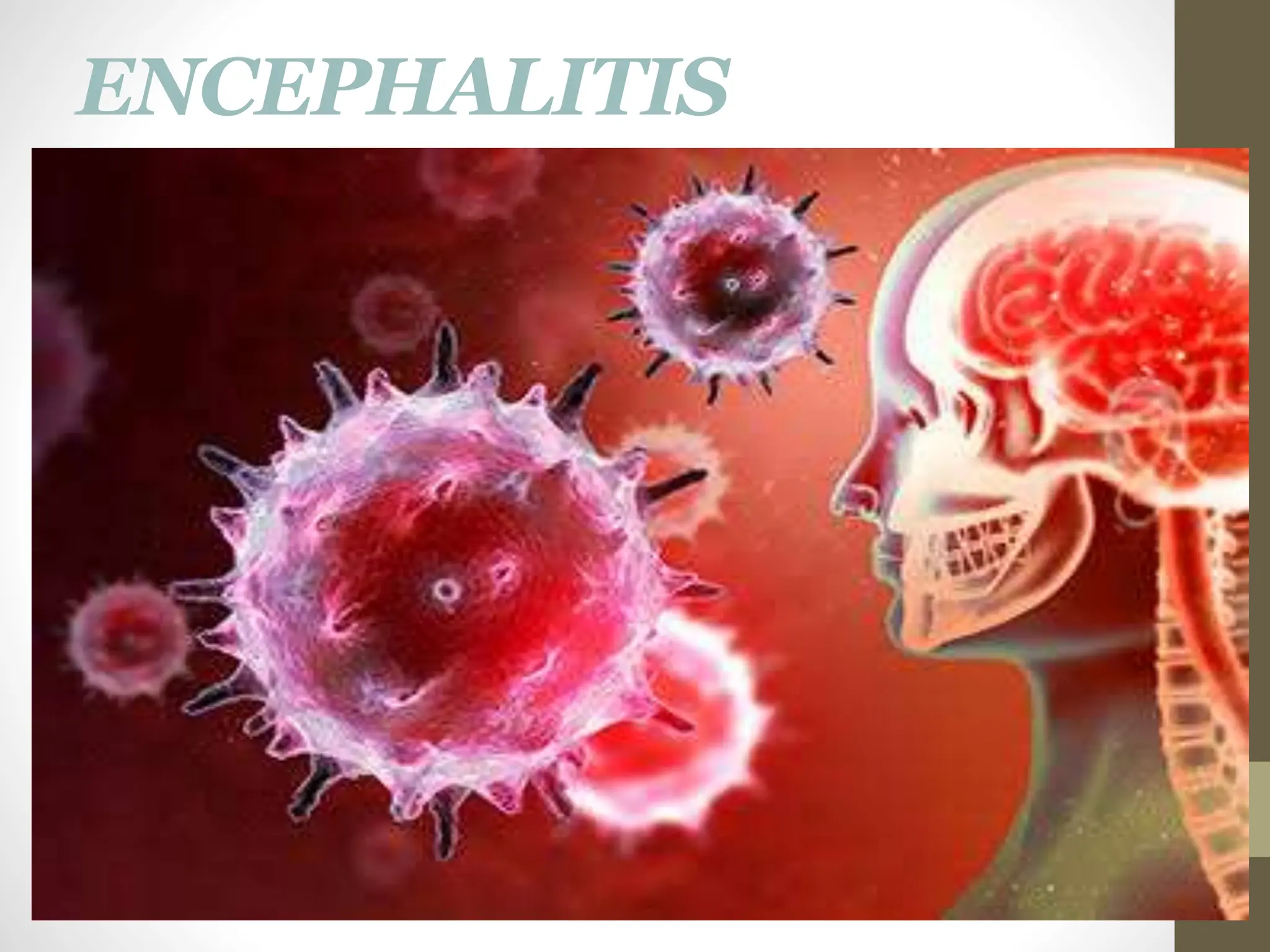 ENCEPHALITIS
 