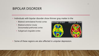 BIPOLAR DISORDER
• Individuals with bipolar disorder show thinner gray matter in the
• Bilateral ventrolateral frontal cortex
• Bilateral anterior insula
Dorsomedial prefrontal cortex
• Subgenual cingulate cortex
• Some of these regions are also affected in unipolar depression.
100
 