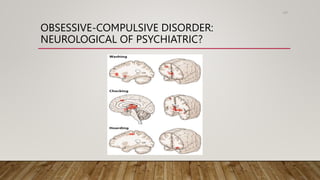 OBSESSIVE-COMPULSIVE DISORDER:
NEUROLOGICAL OF PSYCHIATRIC?
107
 