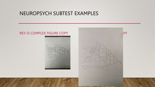 NEUROPSYCH SUBTEST EXAMPLES
REY-O COMPLEX FIGURE COPY ALZHEIMER’S PATIENT COPY
 
