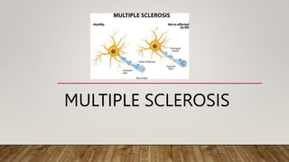 MULTIPLE SCLEROSIS
 
